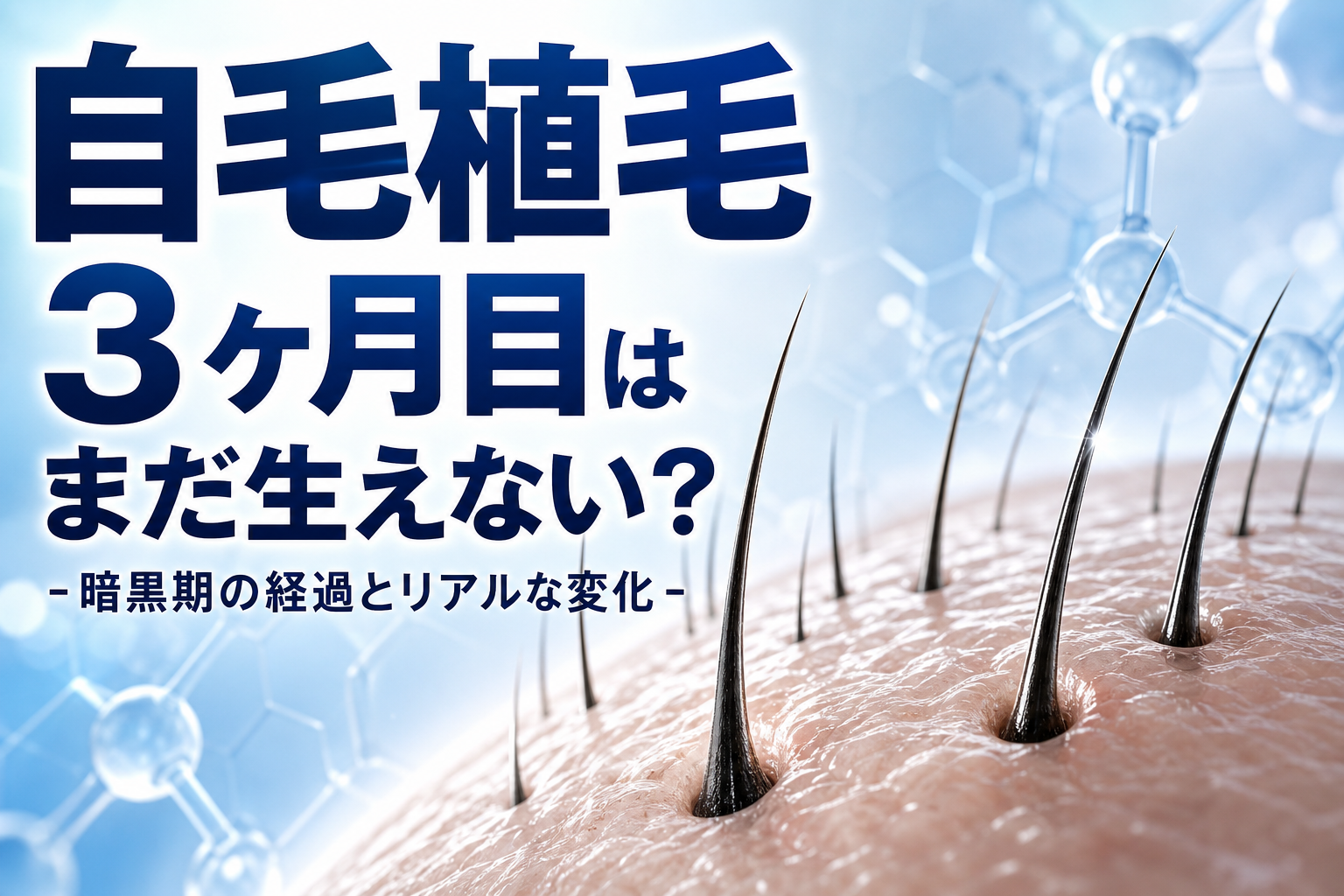 自毛植毛 3ヶ月目はまだ生えない？暗黒期の経過とリアルな変化