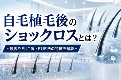 自毛植毛後のショックロスとは？原因やFUT法・FUE法の特徴を解説