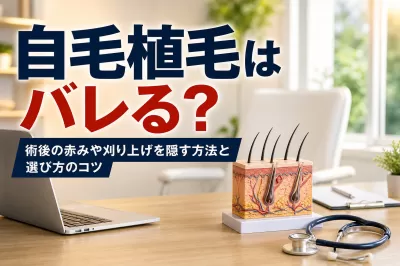 自毛植毛はバレる？術後の赤みや刈り上げを隠す方法と選び方のコツ