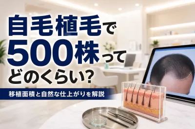 自毛植毛で500株ってどのくらい？移植面積と自然な仕上がりを解説