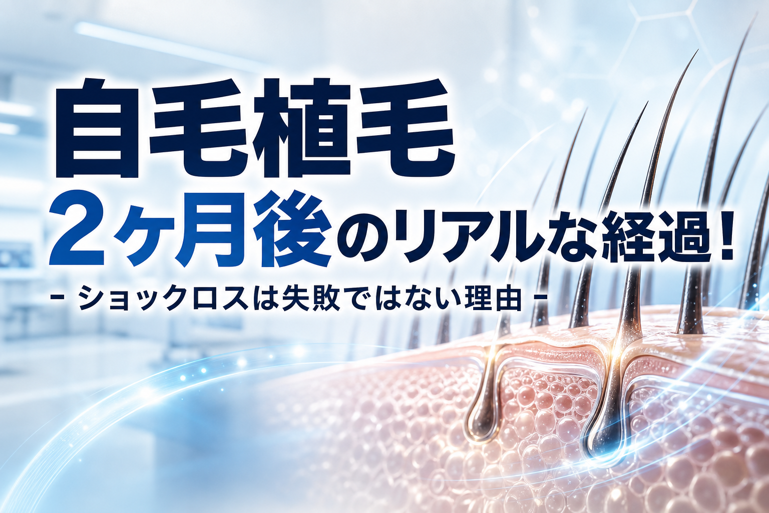 自毛植毛2ヶ月後のリアルな経過！ショックロスは失敗ではない理由